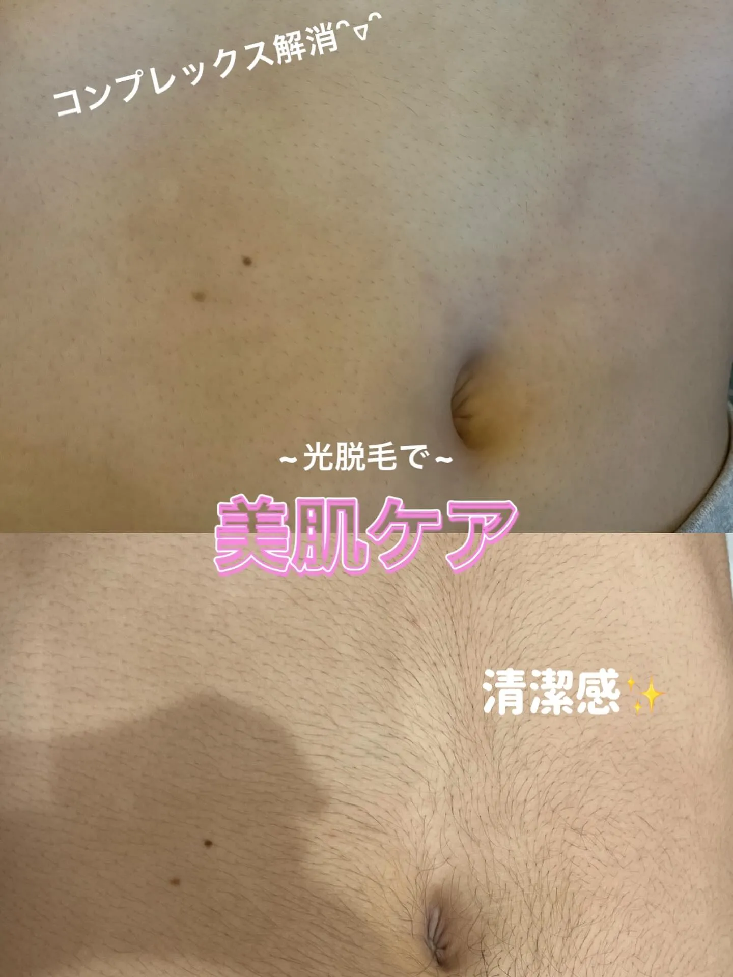 コンプレックスのない自信のある肌をGET✨