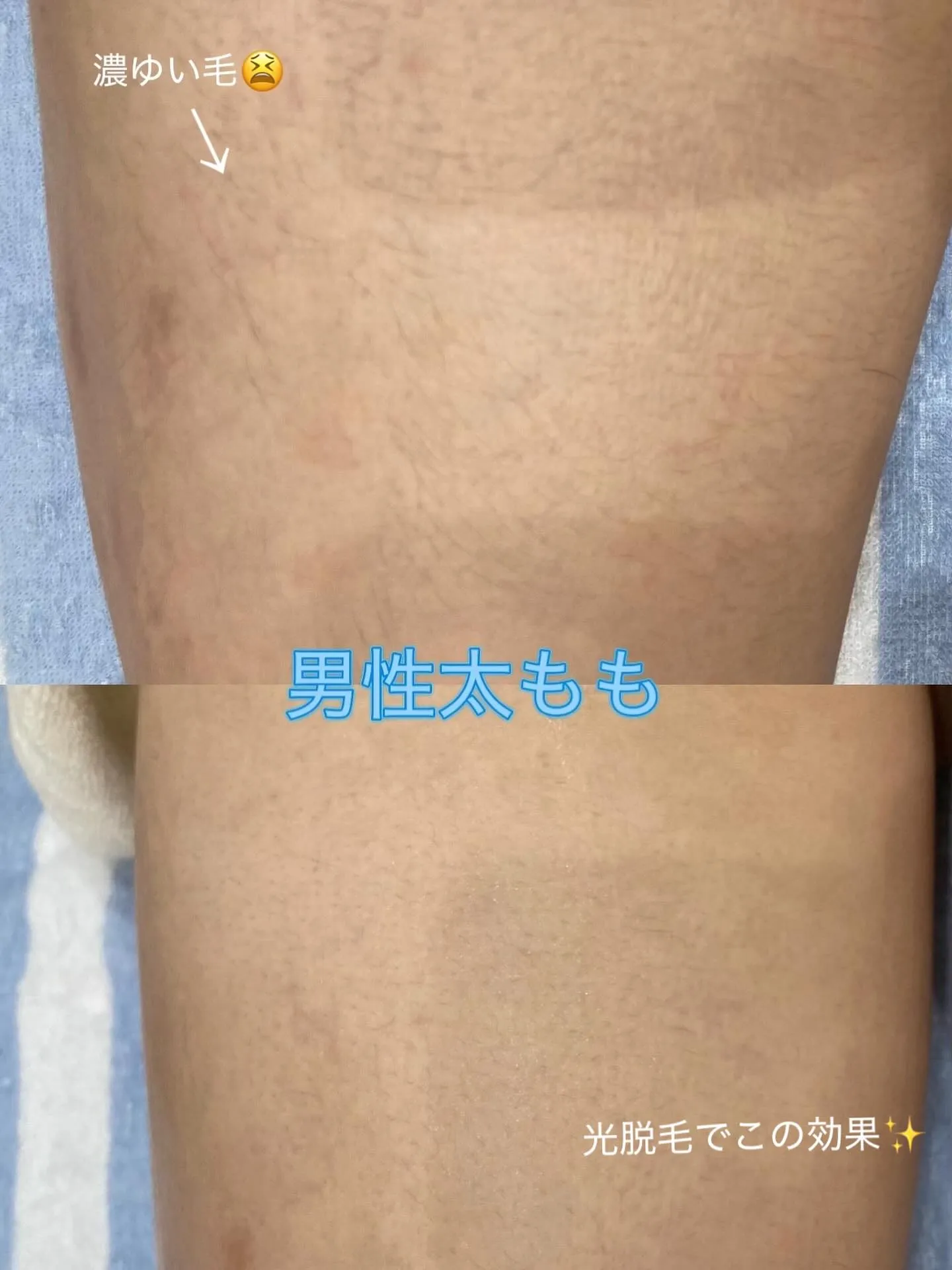 濃ゆい毛の男性も自己処理卒業✌👍🏽